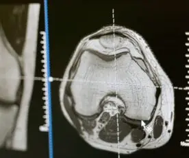 Traumatismos Cranianos – Guia Rápido