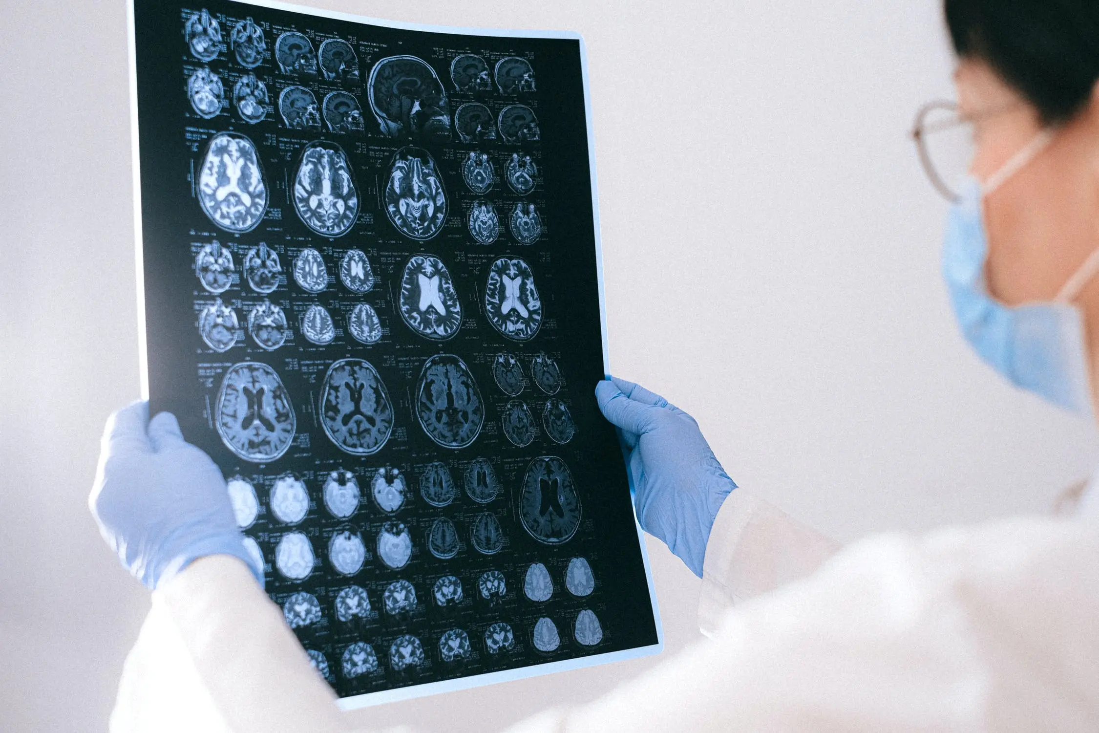 Traumatismo craniano: o que é, sequelas e tratamento traumatismo craniano