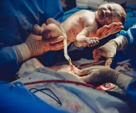 Como Cortar o Cordão Umbilical – Guia Rápido