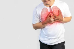 O Que É Tuberculose – Guia Rápido O Que É Tuberculose – Guia Rápido