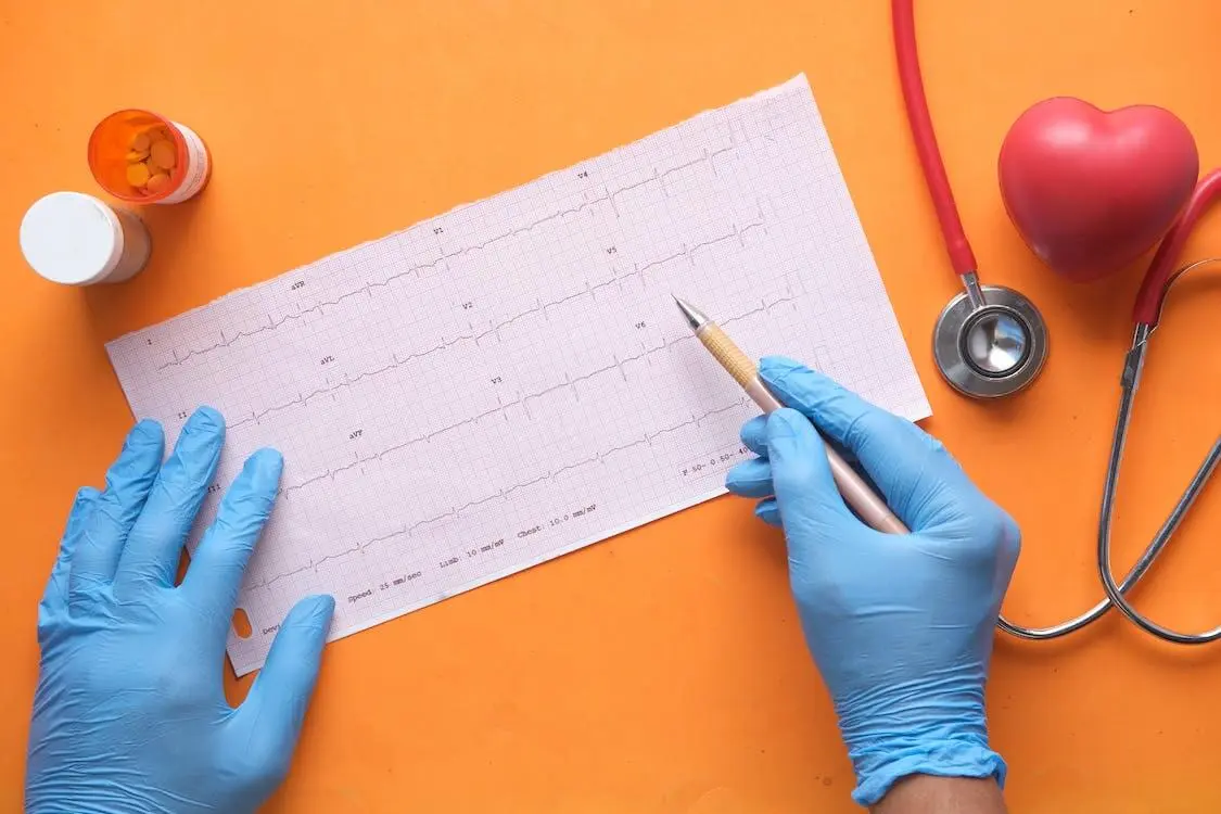 Eletrocardiograma a domicílio eletrocardiograma